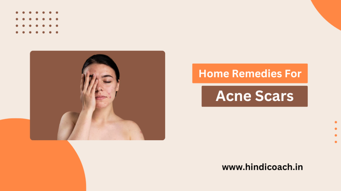 Top 10 Home Remedies For Acne Scars